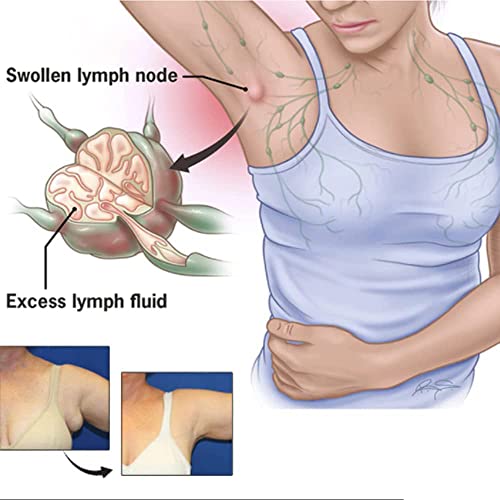 CSIYANJRY99 Lymph Purifying Ring Lymphatic Drainage Therapeutic Rings Set