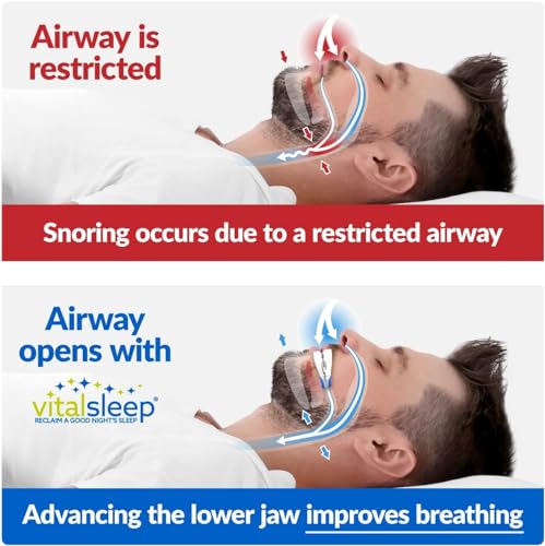 VitalSleep Anti-Snoring Mouthpiece, Adjustable Jaw Positioning