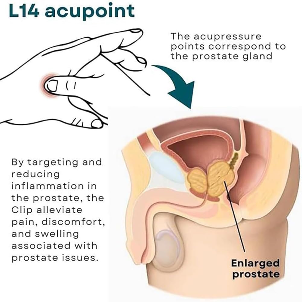 2pcs Prostate Care Point Clip for Men,Acupressure Hand Pressure Point Clip, Relieve Prostate DEFUAUKE