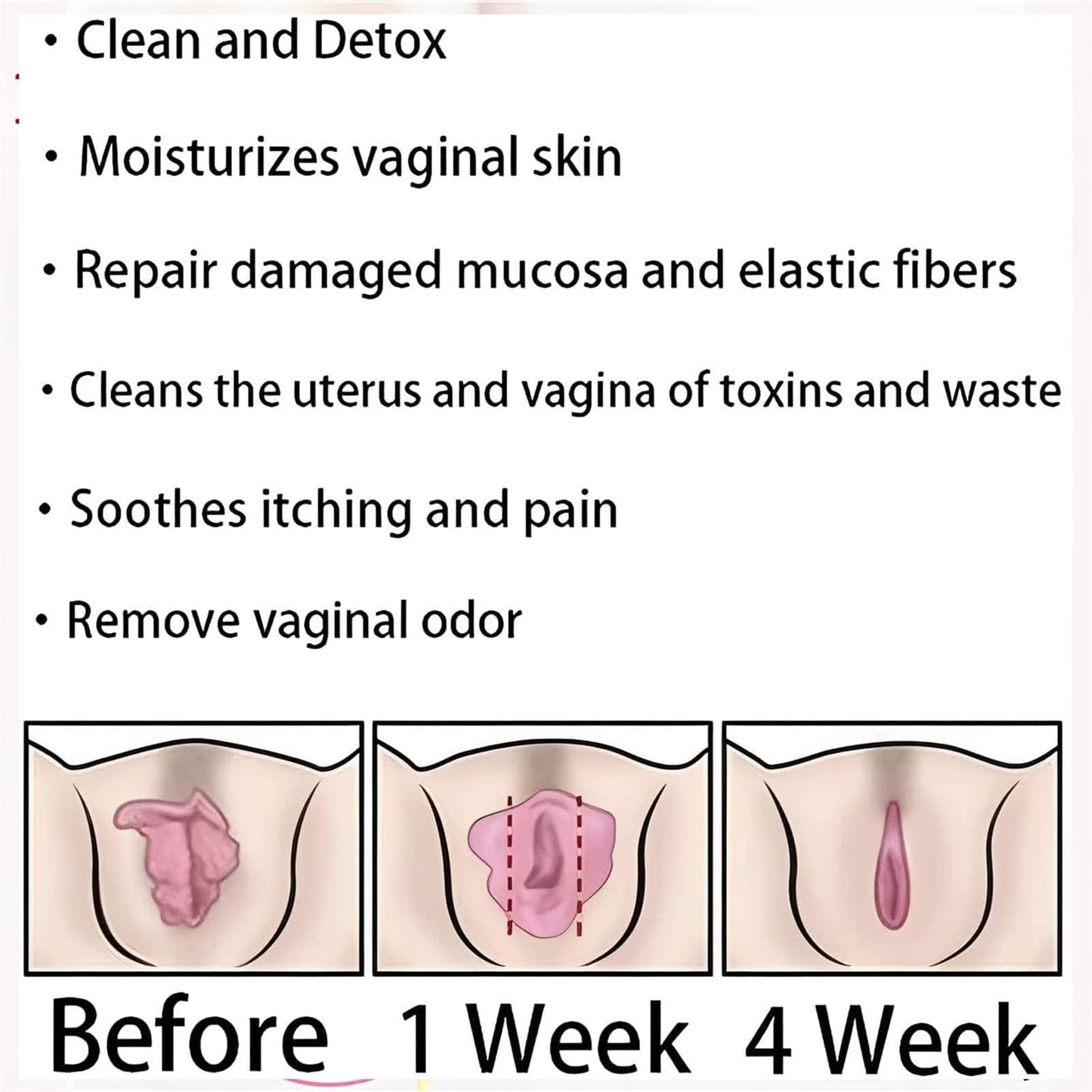 Dexcara Detox Repair, AnnieCare Natural Repair Vaginal Capsules, Anniecare Instant Anti