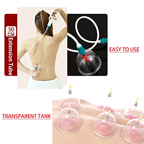 MYMM 12 Cupping Cups Sets Biomagnetic Traditional Professional Chinese Therapy Massage MYMM