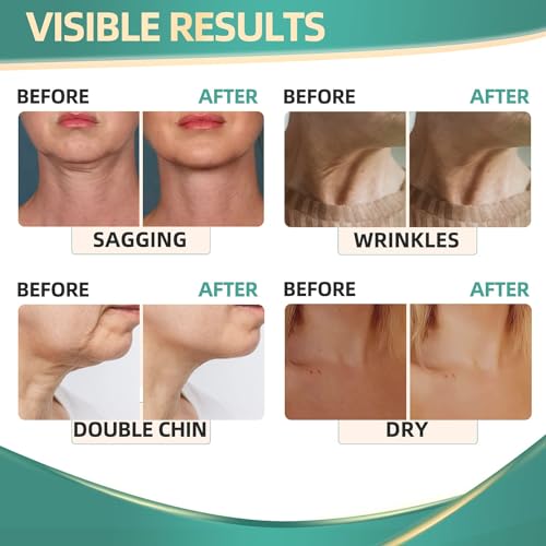 Neck Cream for Tightening Firming: Instant Face Lift Cream - Wrinkle Cream for Women RONKIE