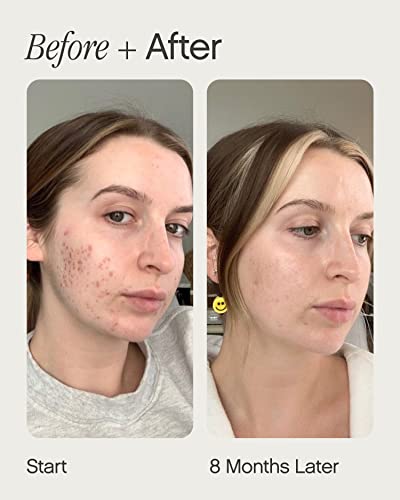Topicals Mini Faded Skin Serum for Brightening and Clearing Uneven Skin