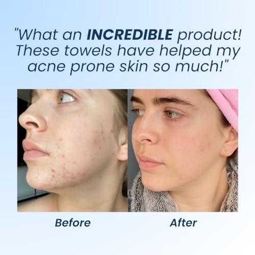 Clean Skin Club Clean Towels XL, Dermatologist Approved, 100% USDA