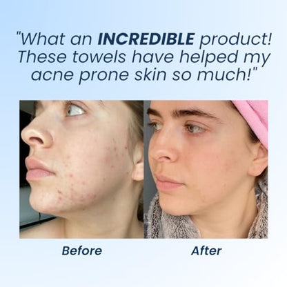 Clean Skin Club Clean Towels XL, Dermatologist Approved, 100% USDA