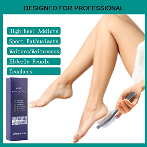 CAREHOOD Foot File Callus Remover - Multi Purpose 4 in 1 Feet Pedicure