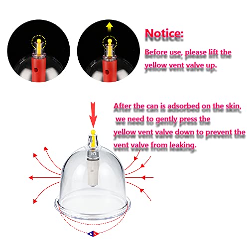 MYMM 12 Cupping Cups Sets Biomagnetic Traditional Professional Chinese Therapy Massage MYMM