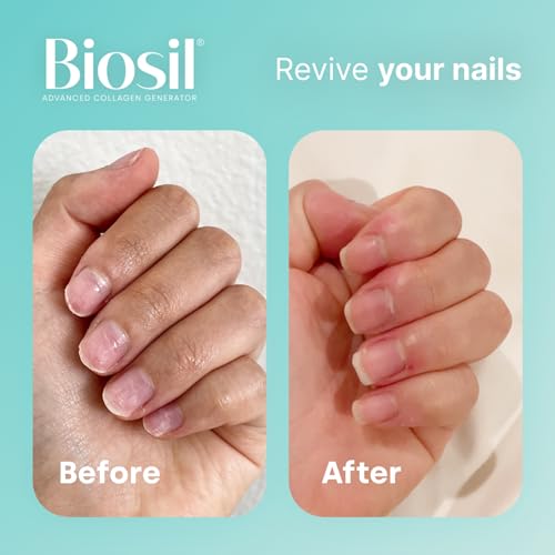 Biosil Collagen Generator - 60 Capsules - with Patented ch-OSA Complex - Generates & Protects BioSil