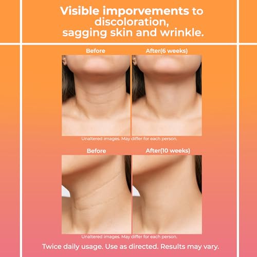 Neck Firming Cream for Women: Neck Cream - Neck Tightening Cream - Neck Creams Lemcuh