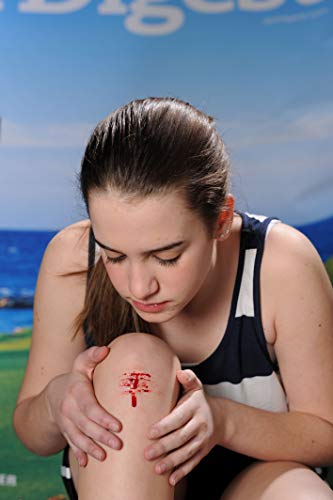 BleedCEASE First Aid for Cuts and Nosebleeds Sterile Packings, 25 Count BleedCEASE