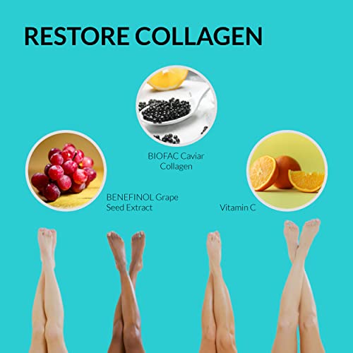 UpNourish Anti Cellulite Supplements - Varicose Veins Support, Restless Leg Relief UpNourish