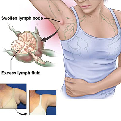 CSIYANJRY99 Lymph Purifying Ring Lymphatic Drainage Therapeutic Rings Set
