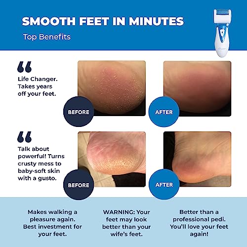 Electric Callus Remover: Own Harmony Professional Pedicure Tools Foot