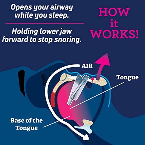 Anti-Snore Device by SmartGuard. New Customizable Snore Reducing SmartGuard