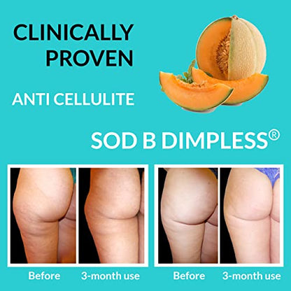 UpNourish Anti Cellulite Supplements - Varicose Veins Support, Restless Leg Relief