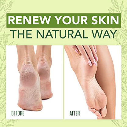 Tea Tree Oil Foot Cream For Dry Cracked Heels Repair - Natural Foot Cream For Dry Cracke