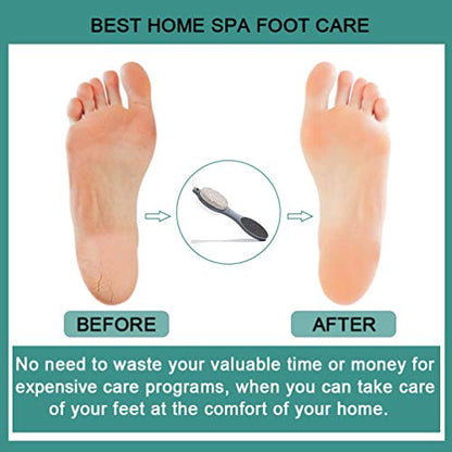 CAREHOOD Foot File Callus Remover - Multi Purpose 4 in 1 Feet Pedicure