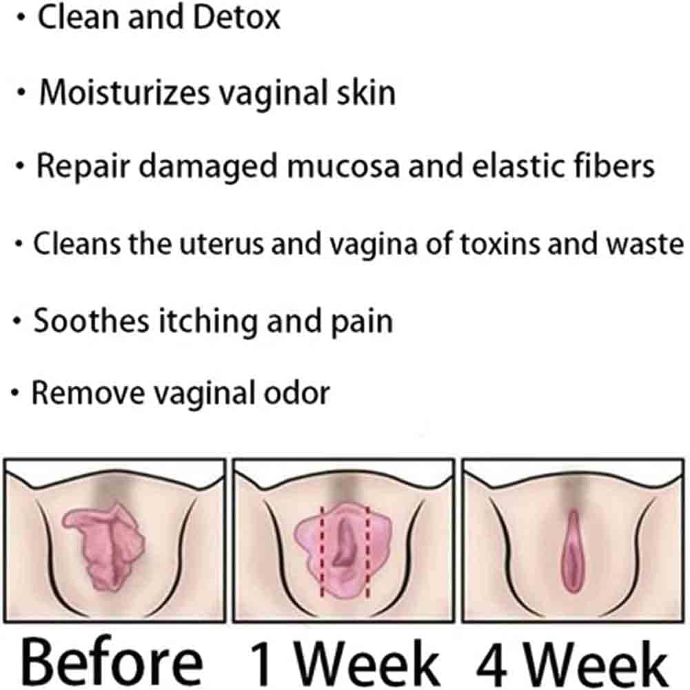 Natural Repair Vagianal Capsules, Anniecare Instant Anti-Itch Detox Slimming Products GDSAFS