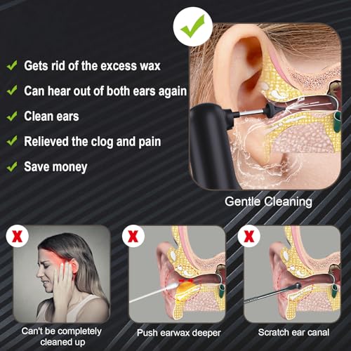 Upgraded Ear Wax Removal,Water Powered Ear Cleaner,Ear Cleaning Kit