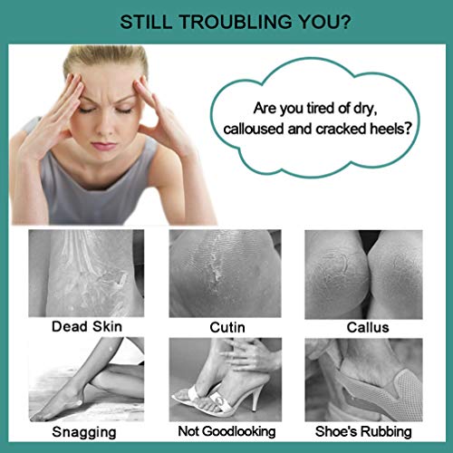 CAREHOOD Foot File Callus Remover - Multi Purpose 4 in 1 Feet Pedicure CAREHOOD