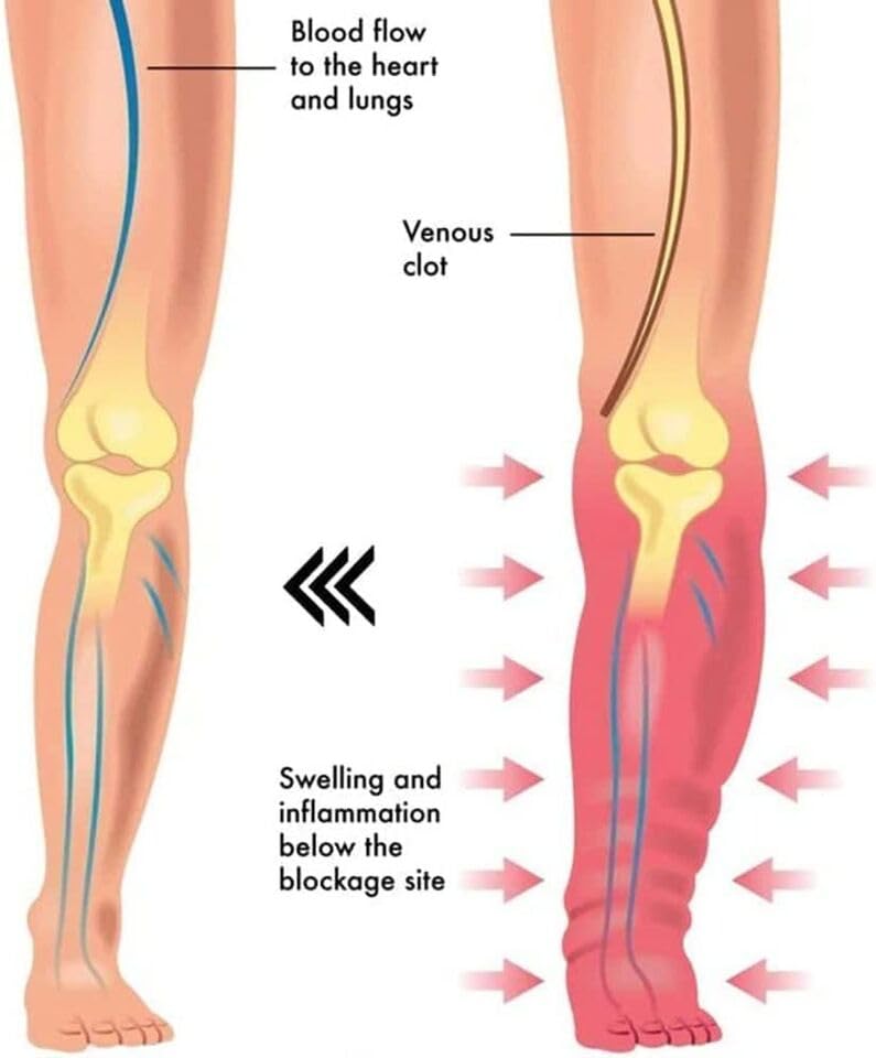 Calmi Ring, Calmi Magnetic Ring, Mens Calmi Ring, Calmi Ring for Women Magnetic (Silver) Generic