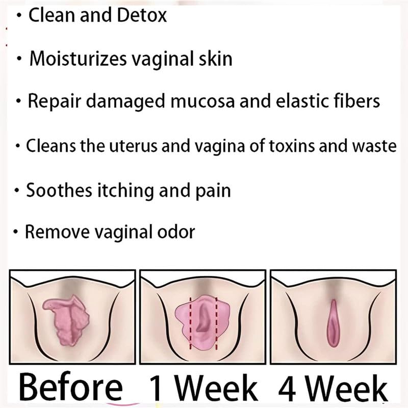 tsoneoo Dexcara Detox Repair - Natural Repair Vagianal Capsules, Natural Repair Vajinal Capsules