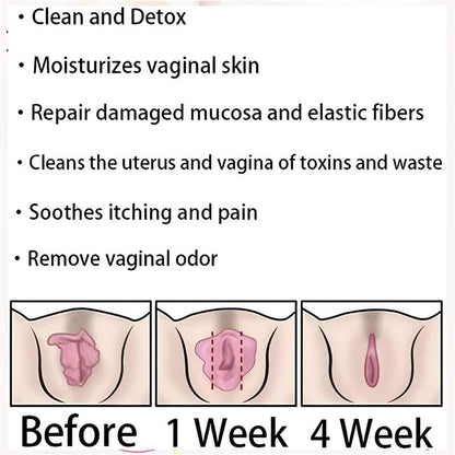 tsoneoo Dexcara Detox Repair - Natural Repair Vagianal Capsules, Natural Repair Vajinal Capsules