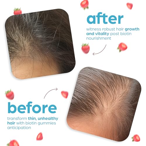 Artnaturals Biotin Gummies for Hair Growth - (100 Gummies - 10000mcg) - Natural Strawberry Artnaturals
