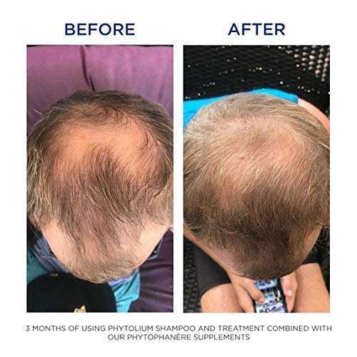 PHYTO Phytophanère 100% Natural Hair Loss Thinning Dietary Supplement PHYTO