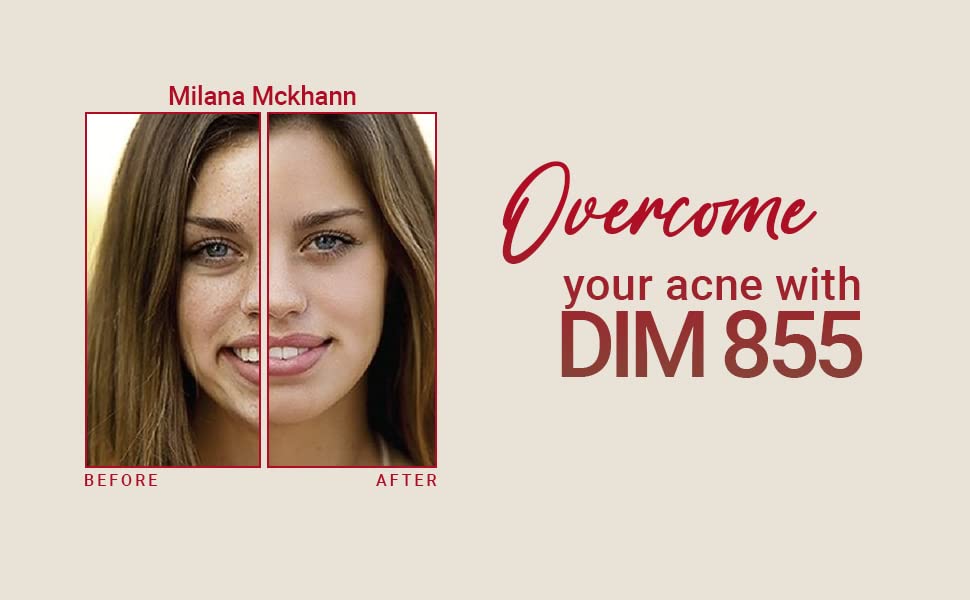 Delgado Protocol - DIM 855 Diindolylmethane Supplement - Improve Estrogen Balance The Delgado Protocol for Health