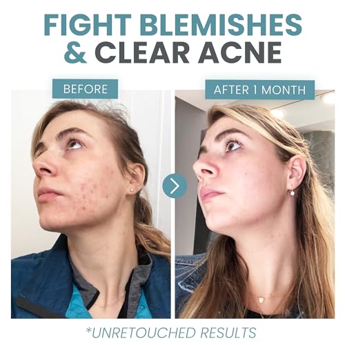 Eva Naturals Vitamin C Face Serum With Hyaluronic Acid - Anti Aging Serum