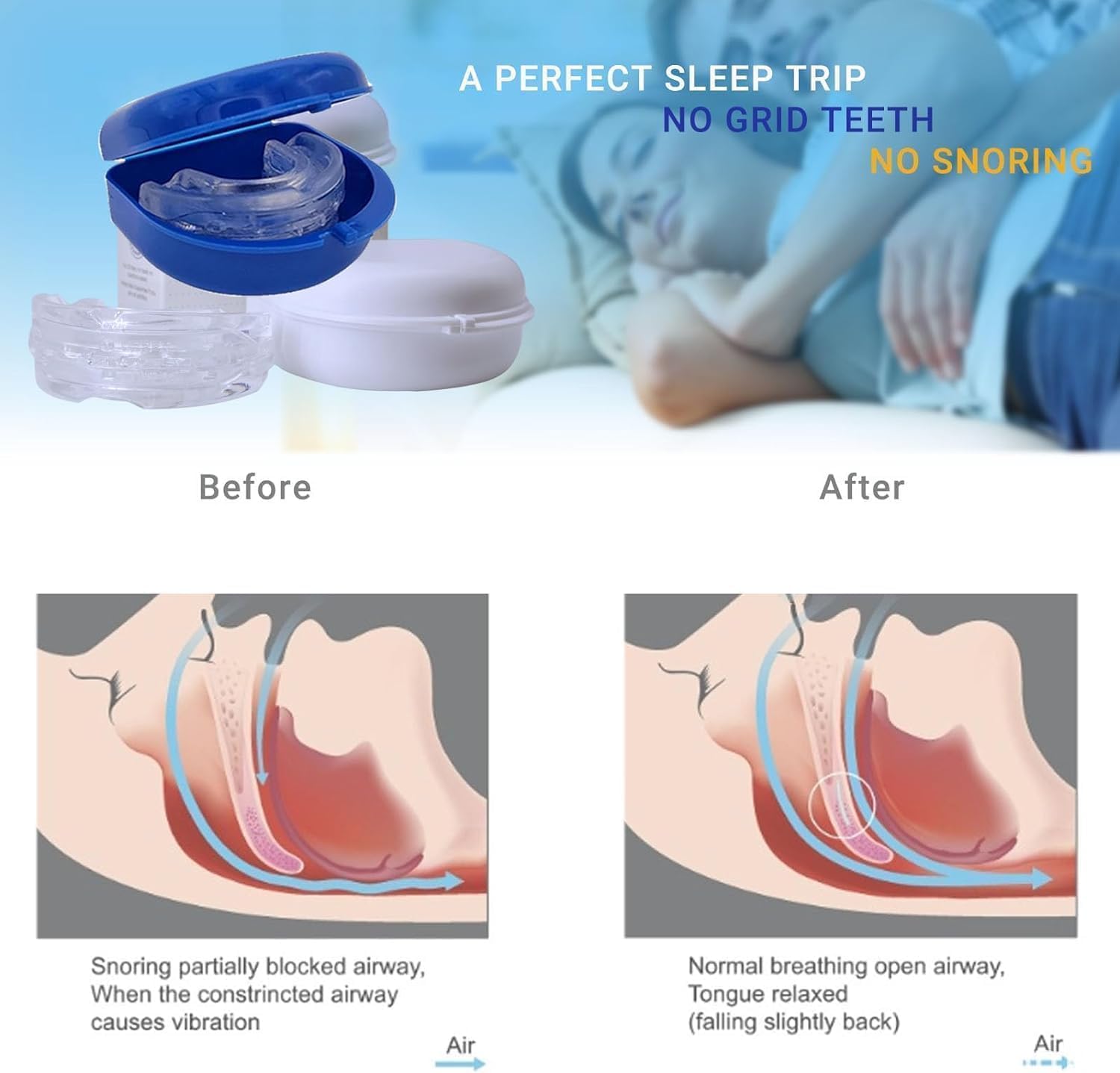 SereneSleep Mouthpiece (Blue) BAWOTY