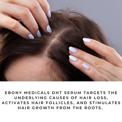 Ebony Medicals DHT Blocker Hair Growth Serum - Hair Loss Supplement, Supports Natural Regrowth