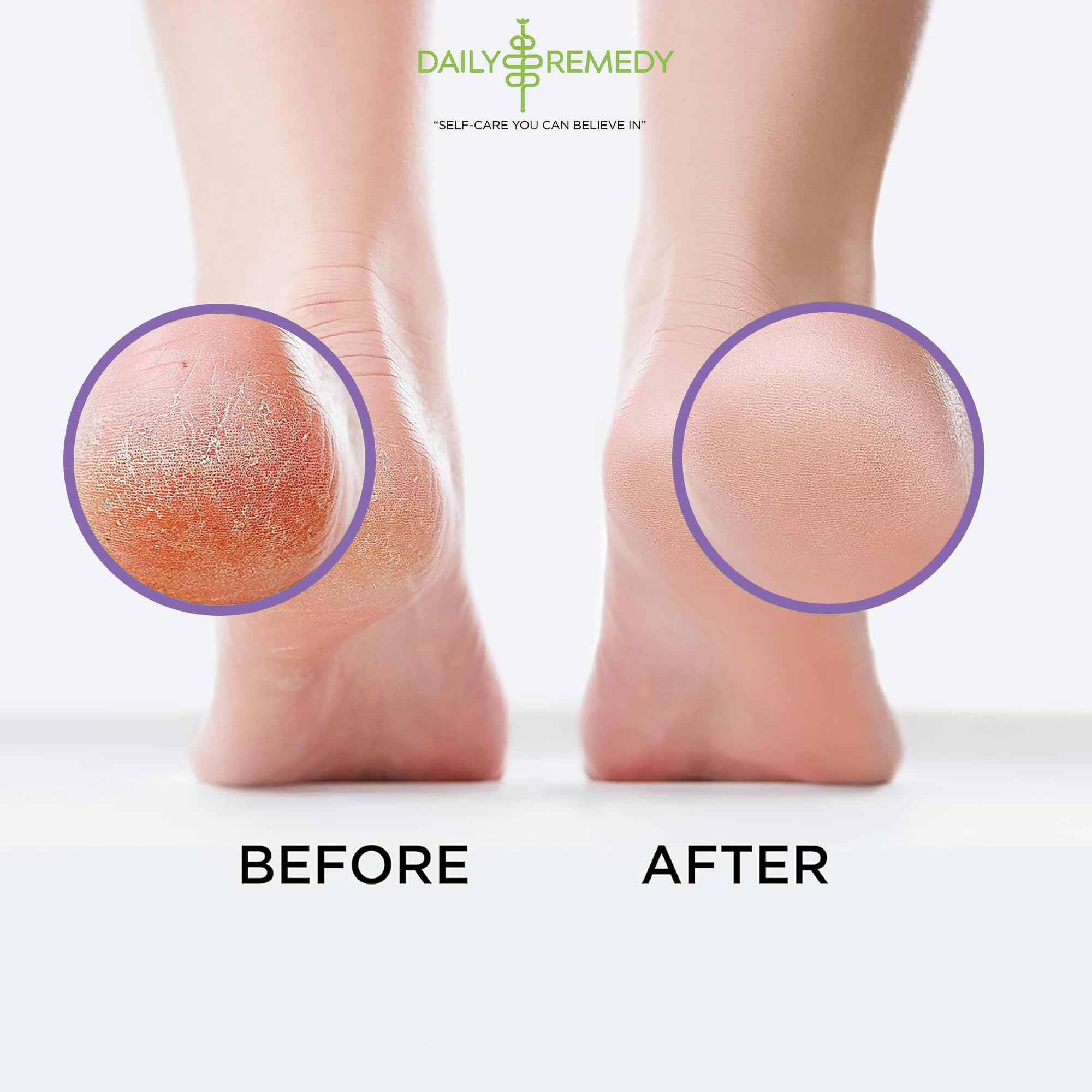 Calming Lavender Foot Soak with Epsom Salt, Made in USA, Foot Soak Soothes Sore Tired DAILY REMEDY