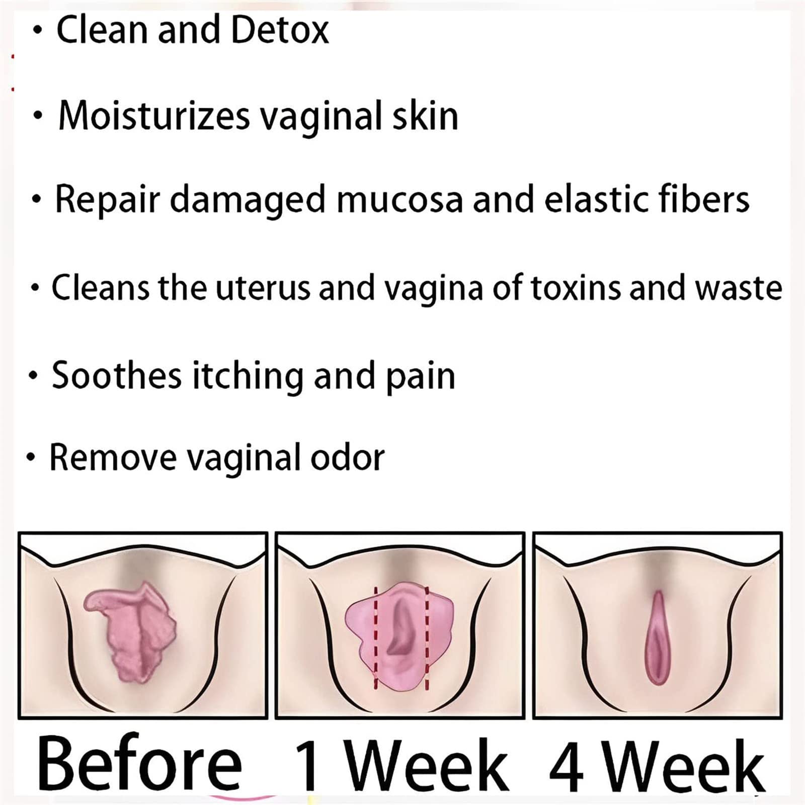 AnnieCare Instant Anti-Itch Detox Slimming Products, Annie Care Natural Detox Viginal Gel DASHENRAN