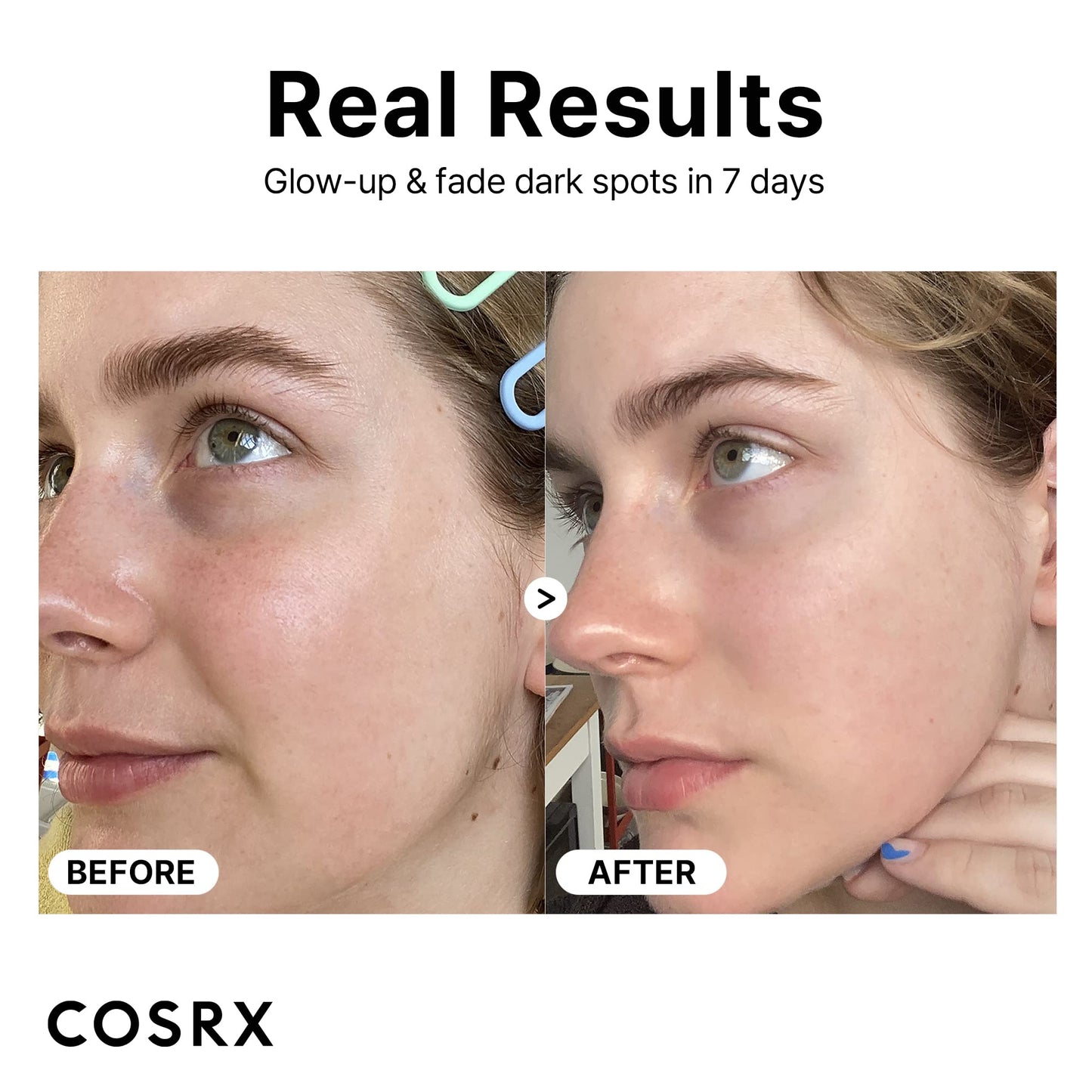 COSRX Pure Vitamin C Serum with Vitamin E & Hyaluronic Acid, Brightening