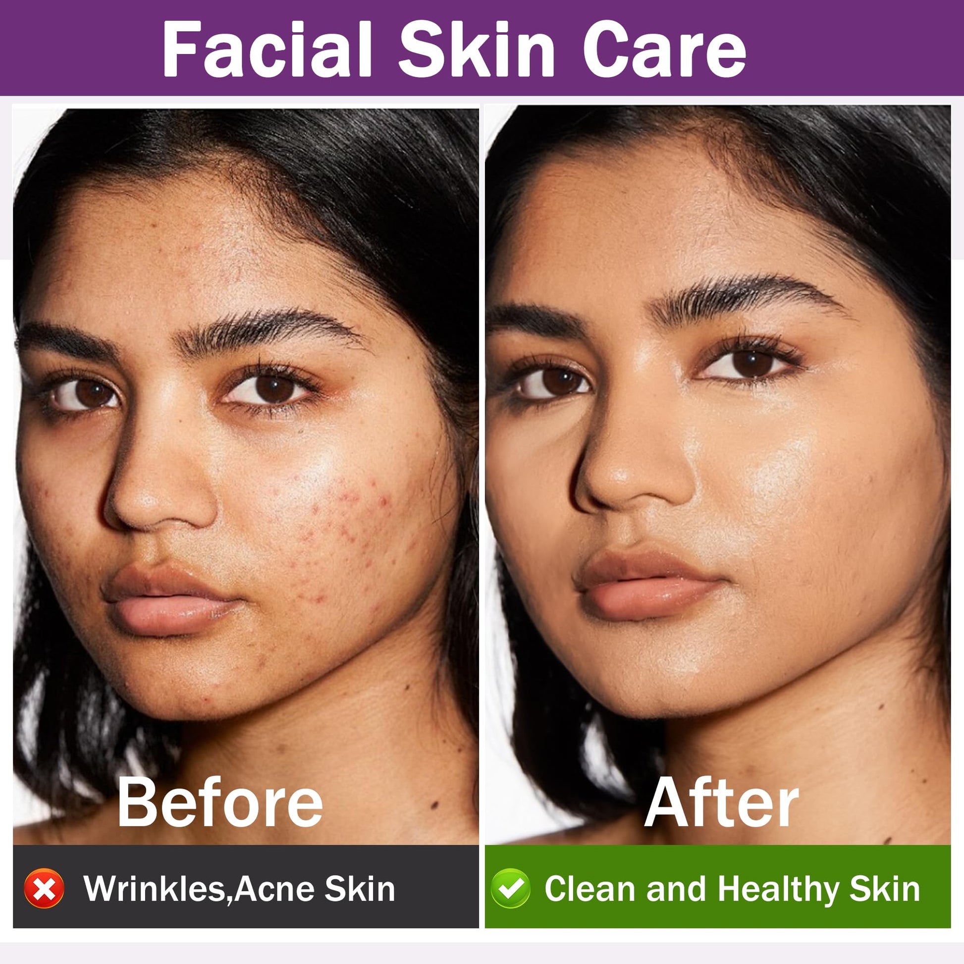 Rosemary Oil for Hair Growth,100% Pure Undiluted Light-Weight Non-Greasy Rosemary Essential Oil GIFBEA