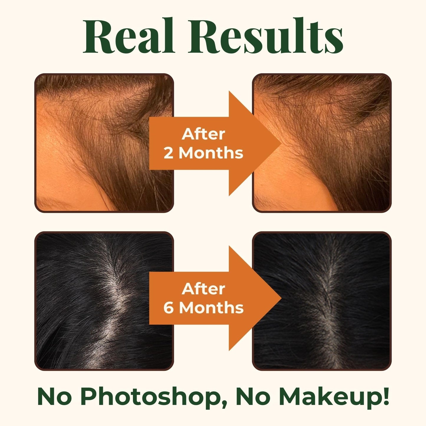 Heebin's Royal Hair, Brows & Lashes, Hair Growth Vitamins with Biotin 4000 mcg, Collagen