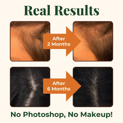 Heebin's Royal Hair, Brows & Lashes, Hair Growth Vitamins with Biotin 4000 mcg, Collagen