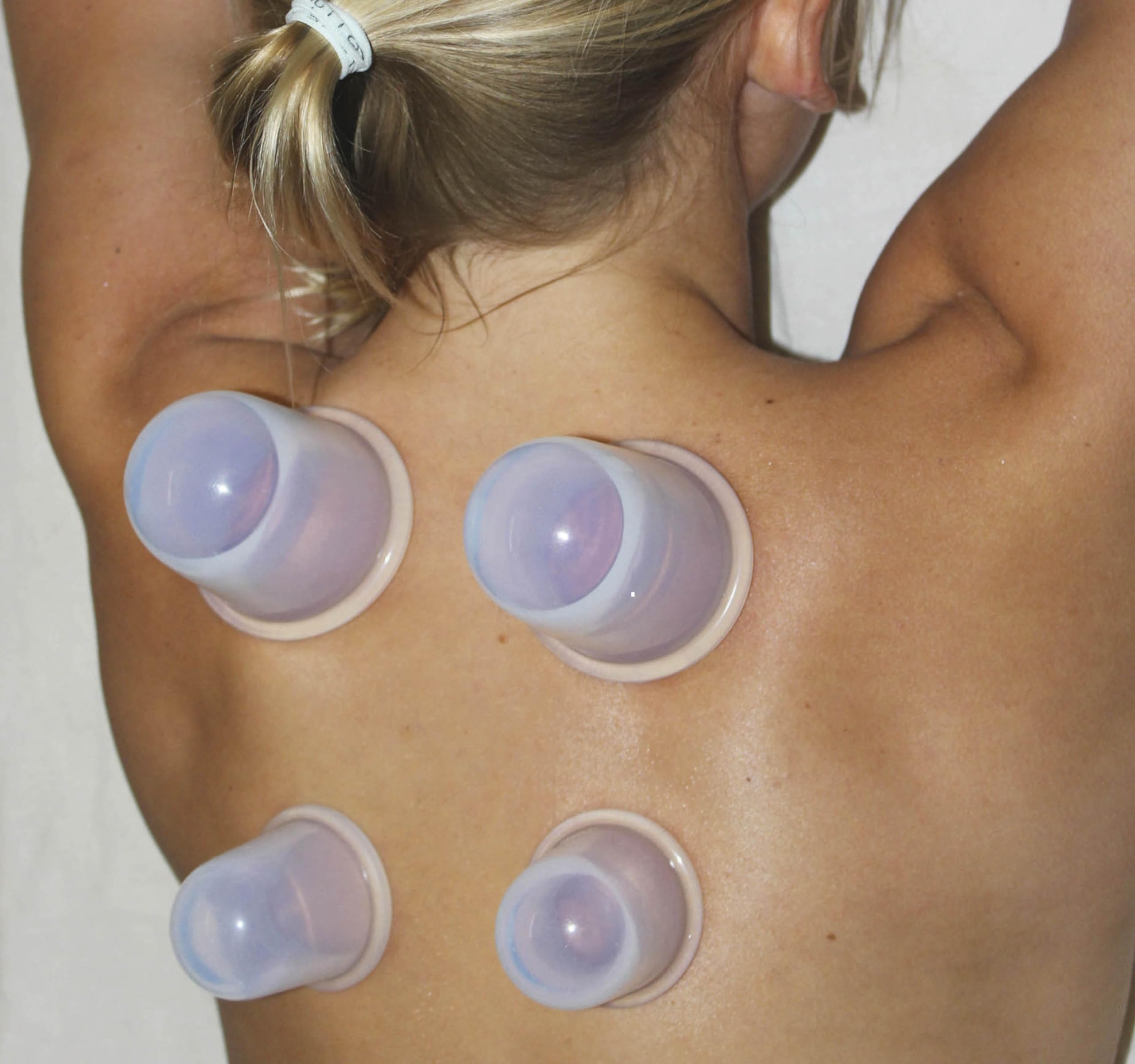 Cupping Kit for Massage Therapy - by DoSensePro, Cupping Set of 6 Professional Silicone Cups DoSensePro