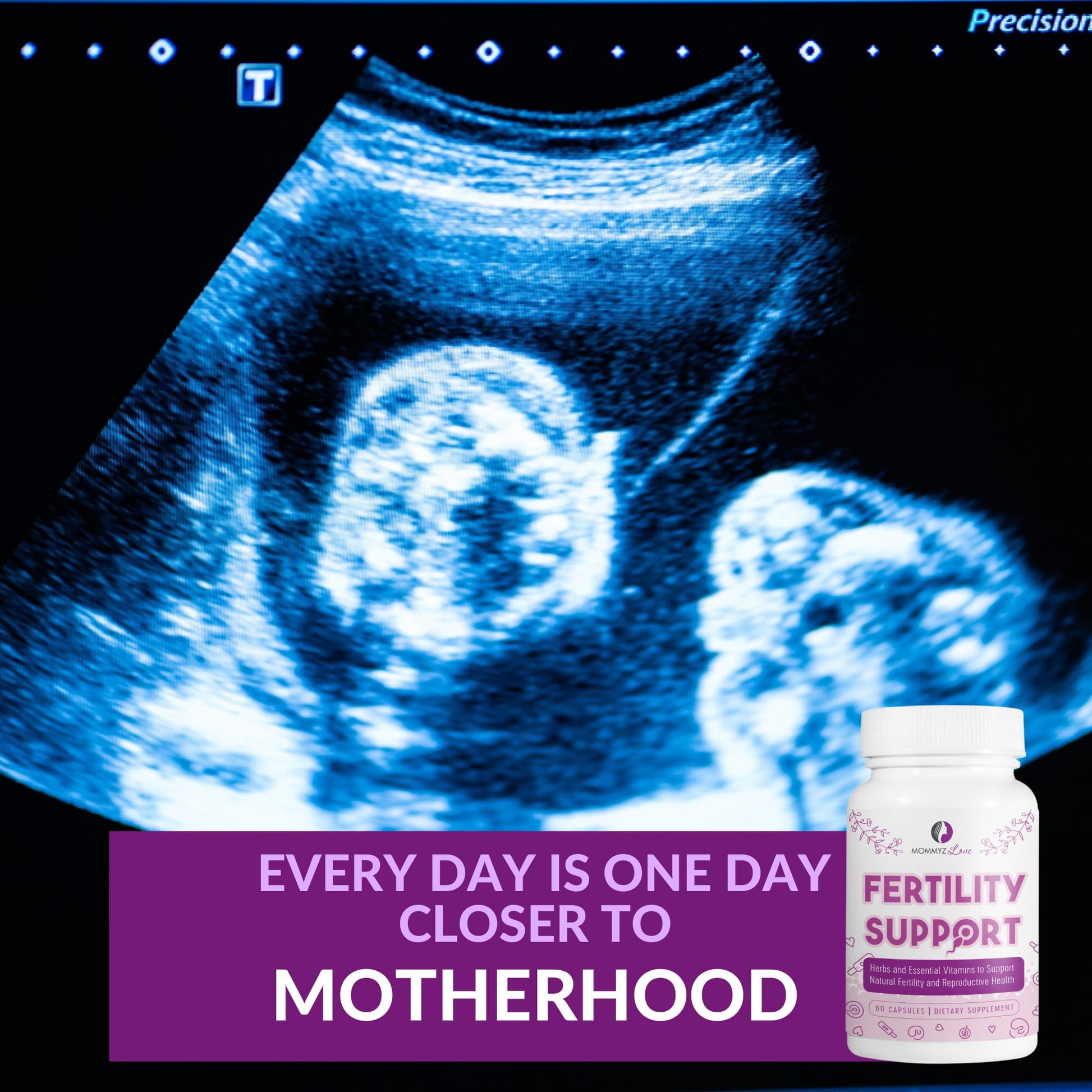 Myo-Inositol Conception Fertility Prenatal Vitamins for Healthy Ovarian Function plus Apple Cider Mommyz Love