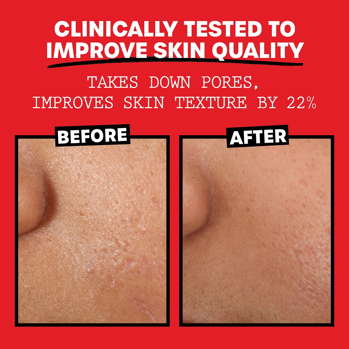 Thayers Alcohol-Free, Hydrating Rose Petal Witch Hazel Facial Toner 12 oz + 3oz