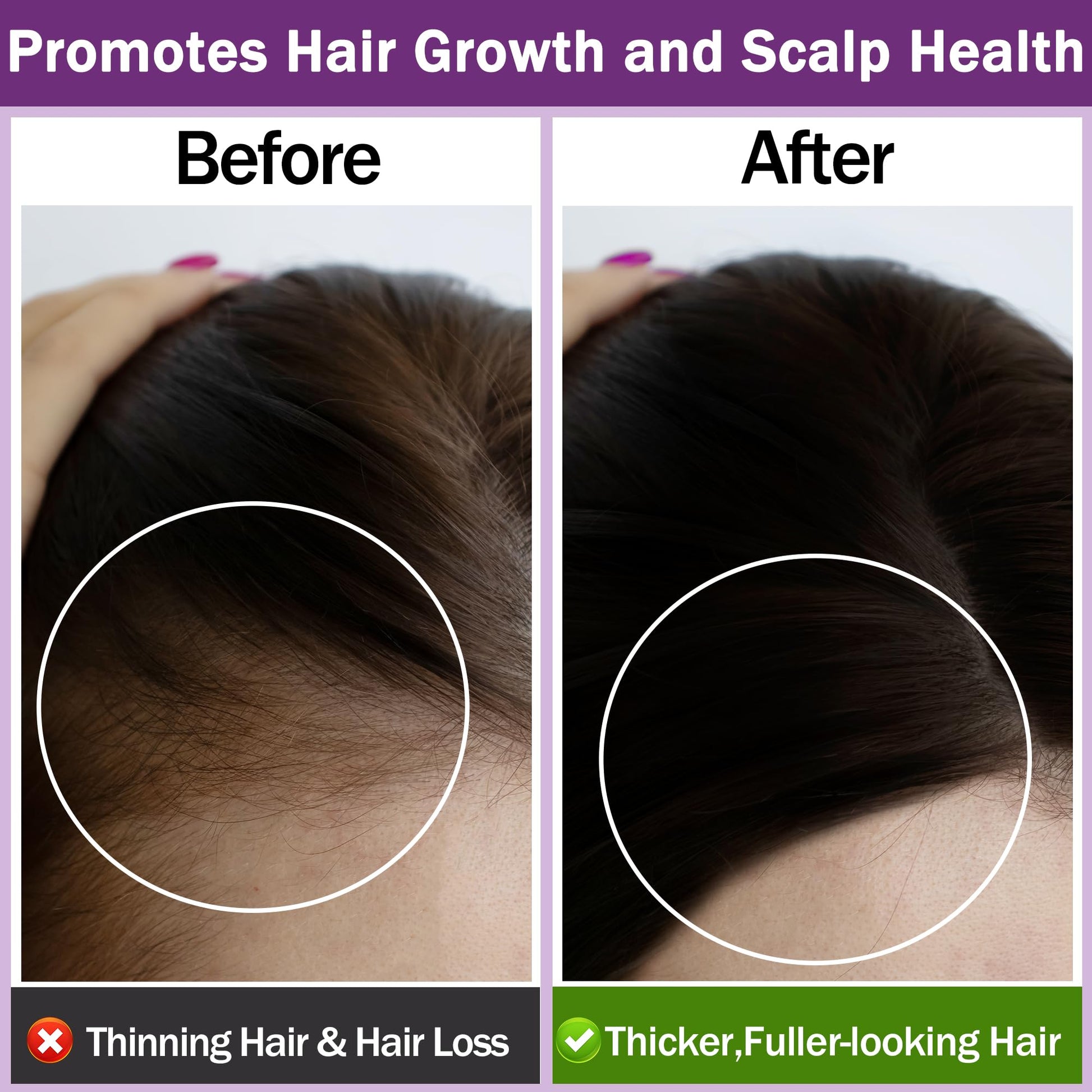 Rosemary Oil for Hair Growth,100% Pure Undiluted Light-Weight Non-Greasy Rosemary Essential Oil GIFBEA