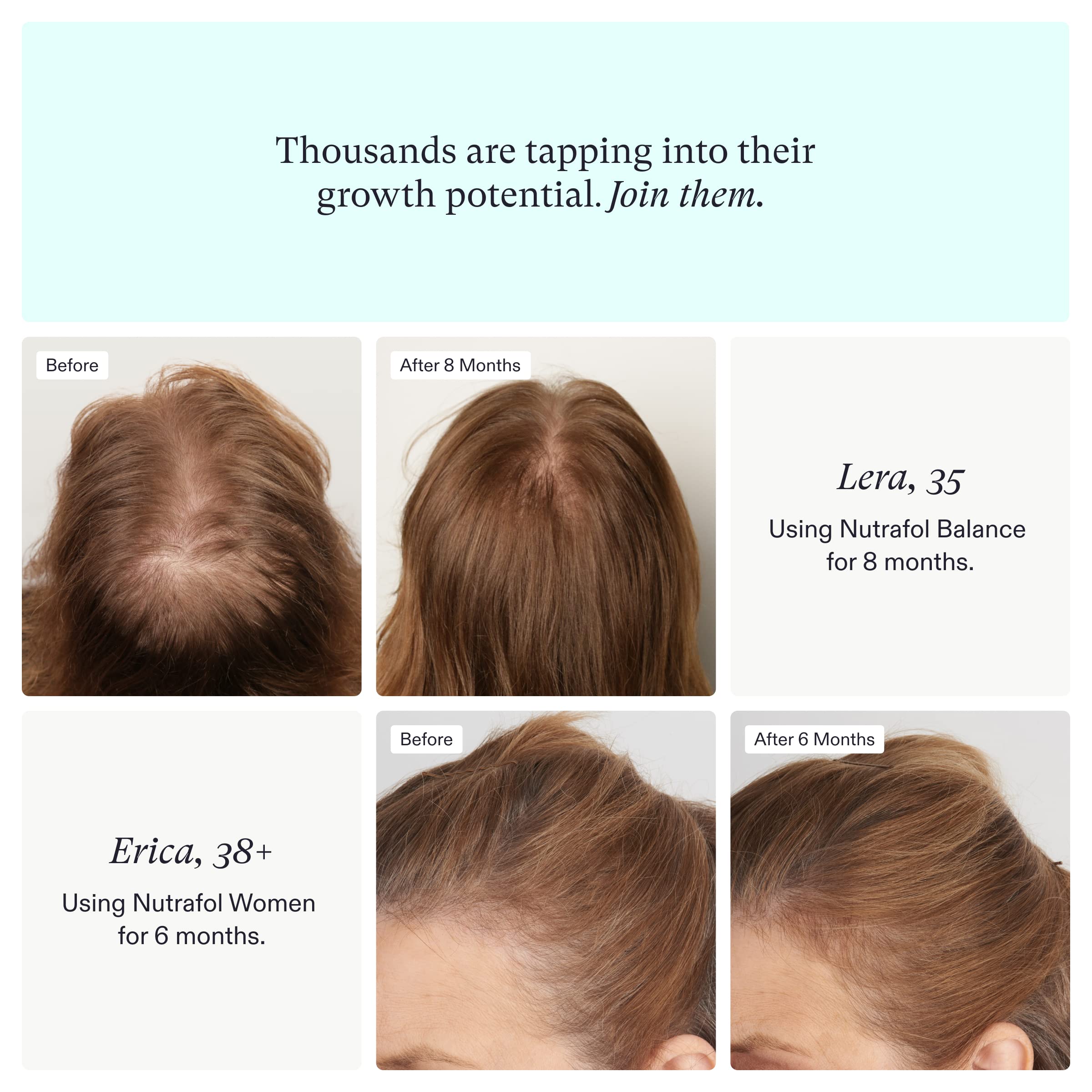 Nutrafol Hair Growth Supplement Bundle | Women Ages 18-44 + Womens Ages 45+ | Clinically Proven Nutrafol